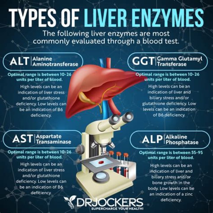 Can liver enzymes be elevated with gallstones