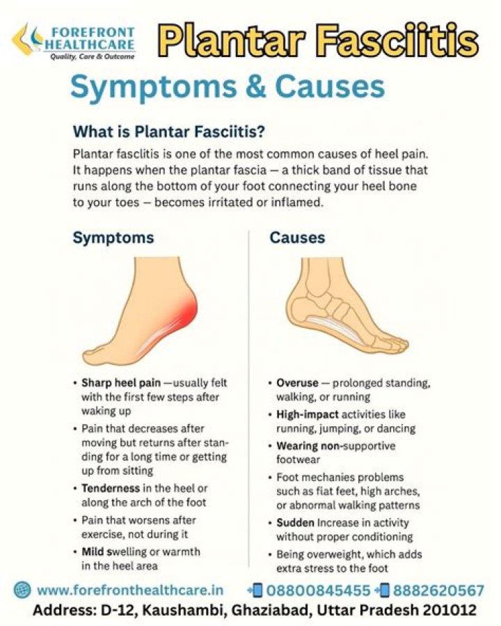Can pes planus cause plantar fasciitis