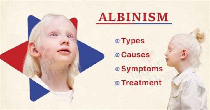 Can you have mild albinism