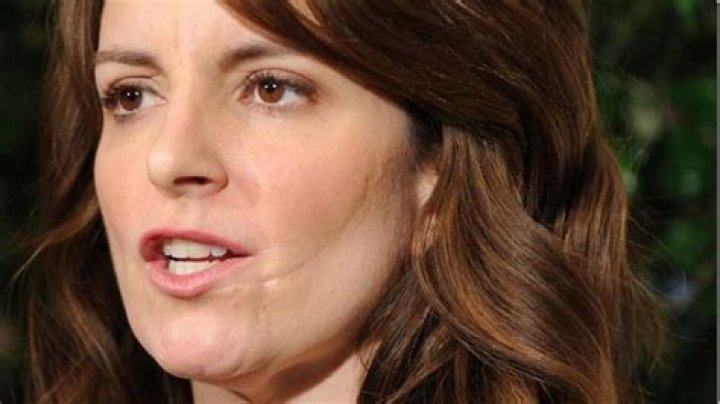 How Did Tina Fey Get Her Scar