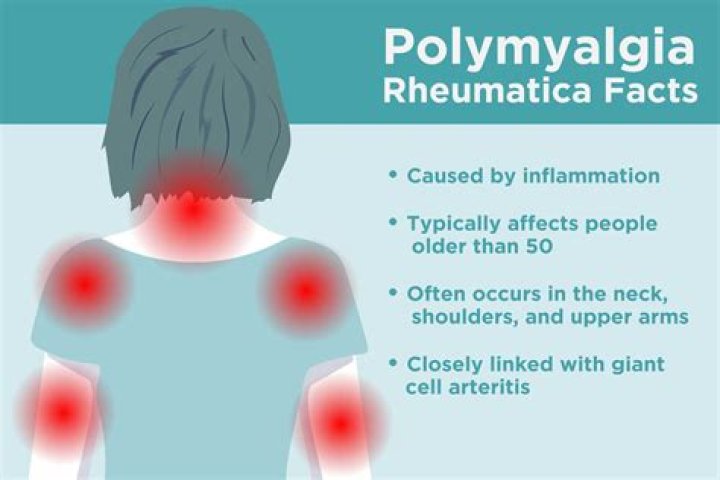 How long can you live with polymyalgia rheumatica