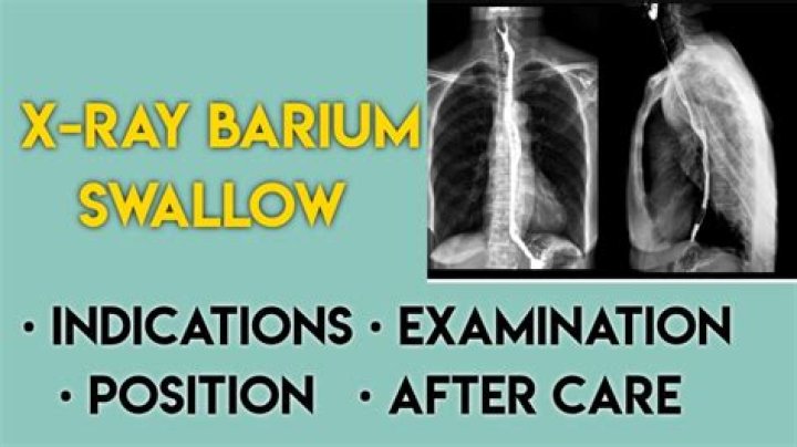 How long does a barium swallow test take