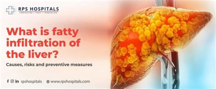 Is fatty infiltration of the liver serious