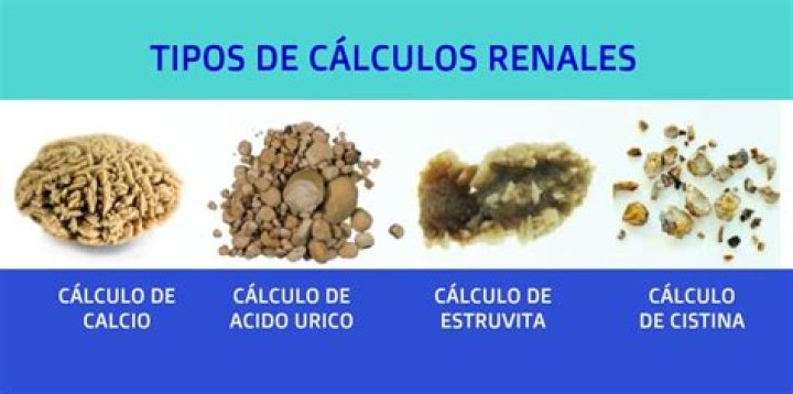 ¿Qué son las células renales en la orina