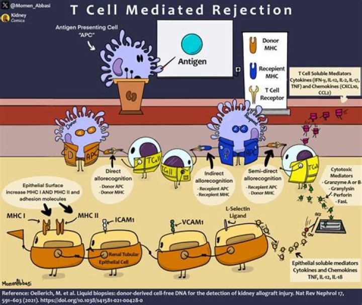 What causes antibody mediated rejection