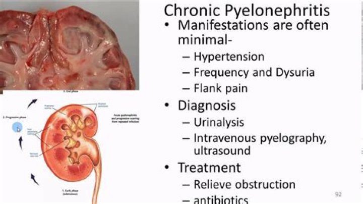 What causes chronic pyelonephritis