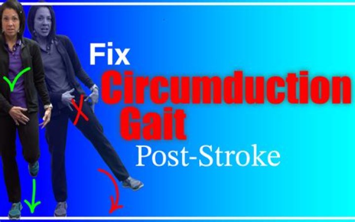 What causes Circumduction