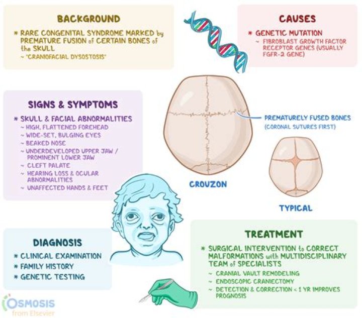 What causes craniofacial disorder