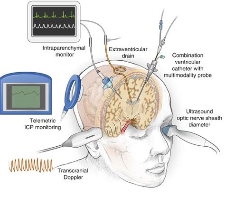 What do you mean by Ventriculostomy care