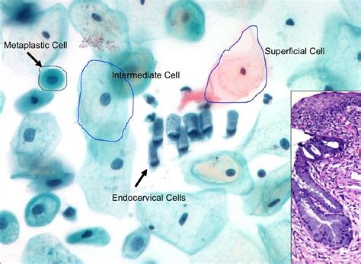What does it mean when endocervical and/or squamous metaplastic cells are present