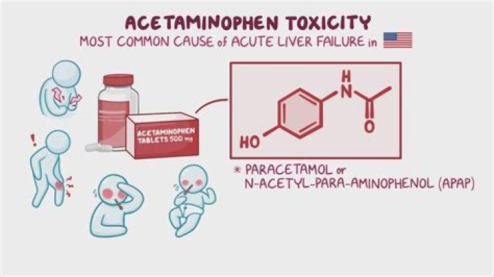 What indicates acetaminophen toxicity