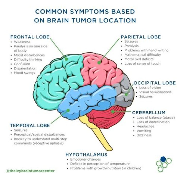 What is considered a large brain tumor