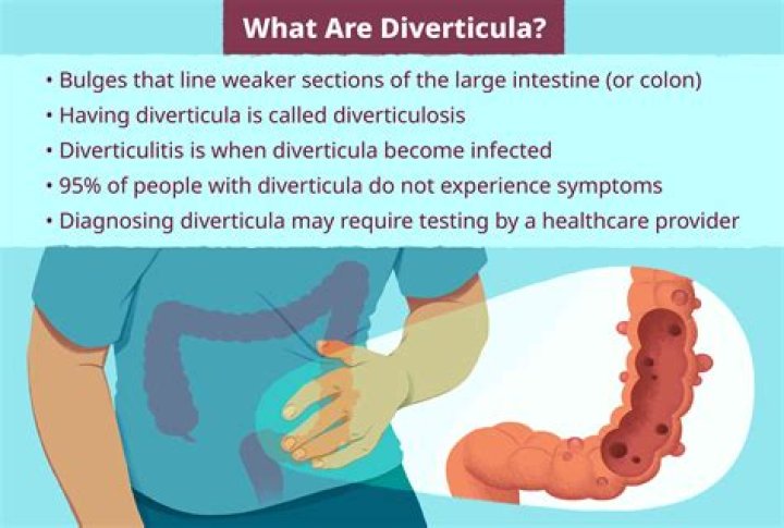 What is diverticula in the bladder