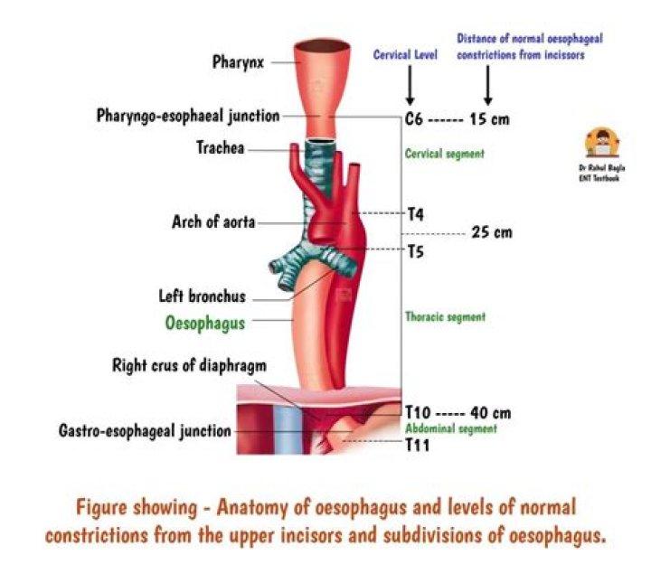 What is the flap at the bottom of your esophagus called