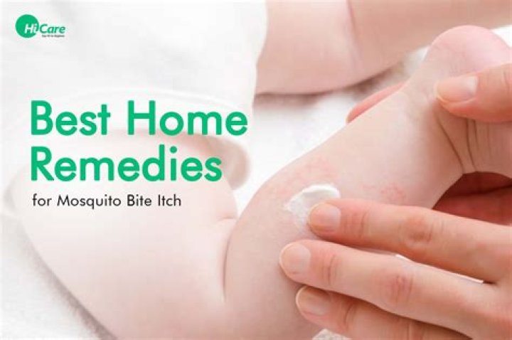 What to use to stop mosquito bites from itching