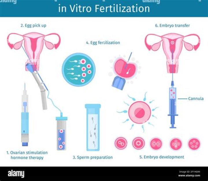 Why Is in vitro fertilization wrong